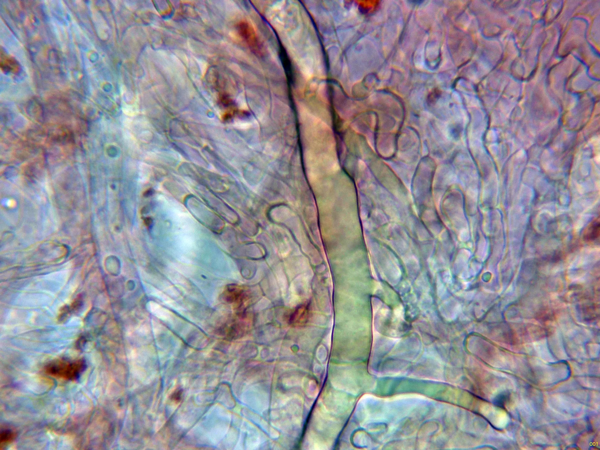 Microscopía de Lactarius subumbonatus - 10 - Hifa laticifera-001
